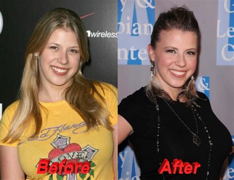 jodie sweetin boobs|Jodie Sweetins plastic surgery thoughts